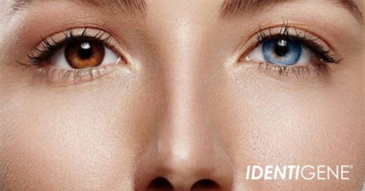 Why Two Different Colored Eyes?