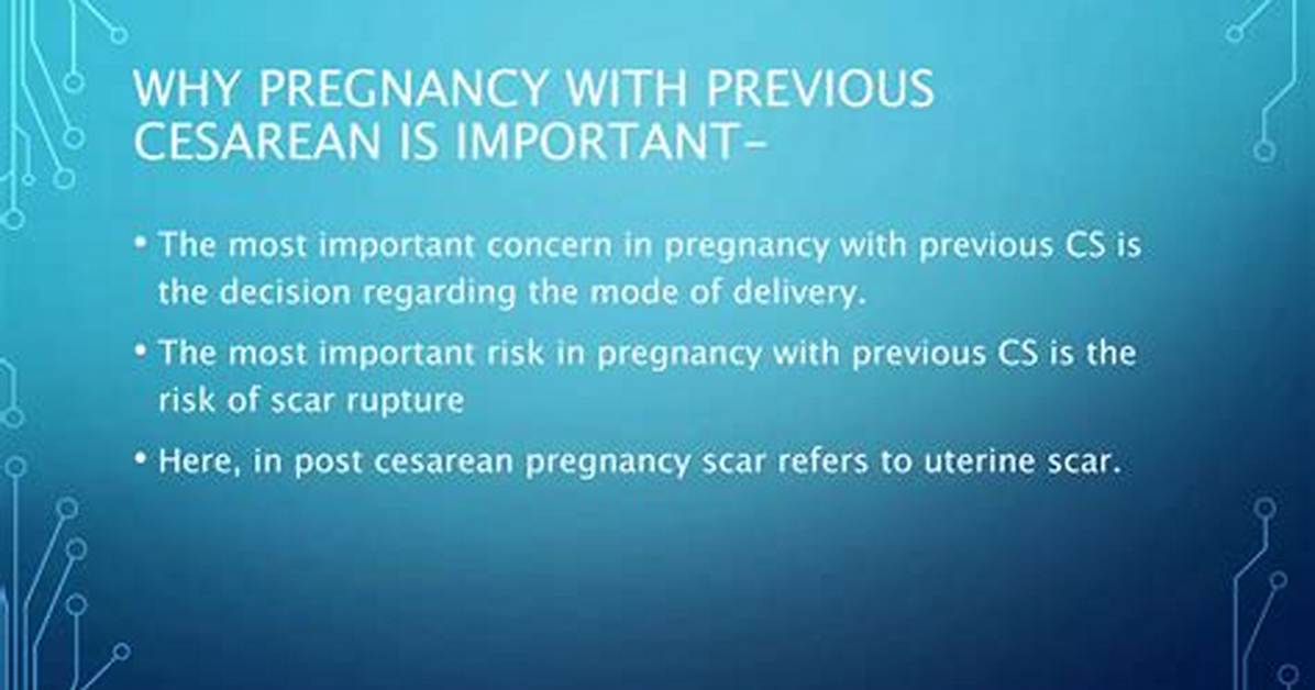Why We Call It Cesarean Section?
