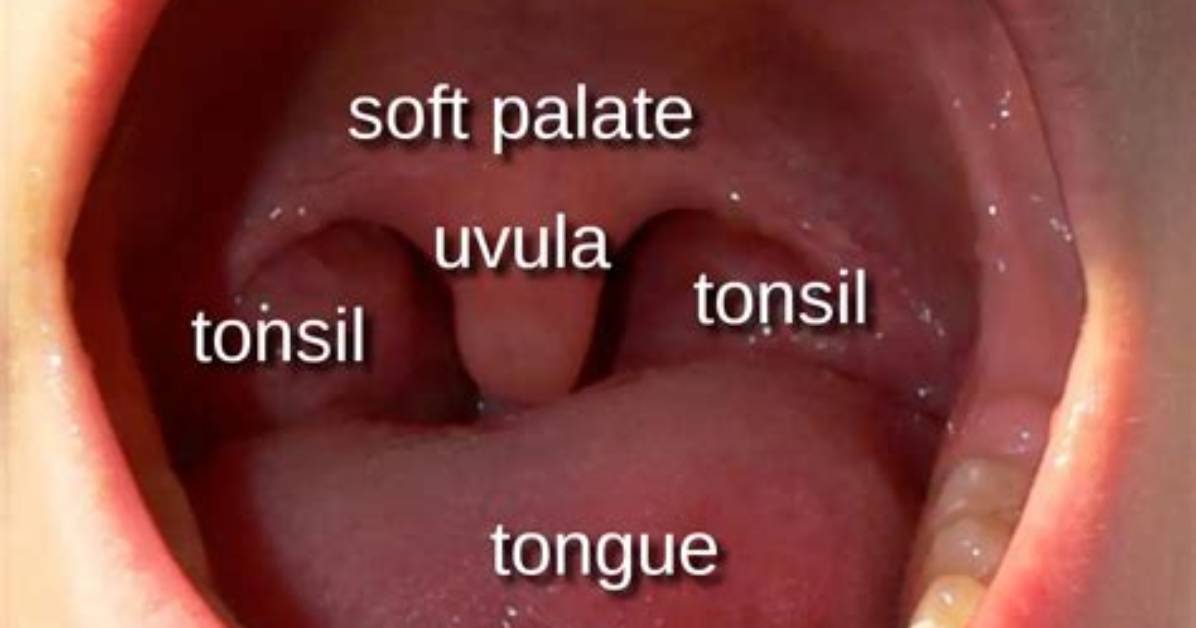 Why Would Uvula Swell?