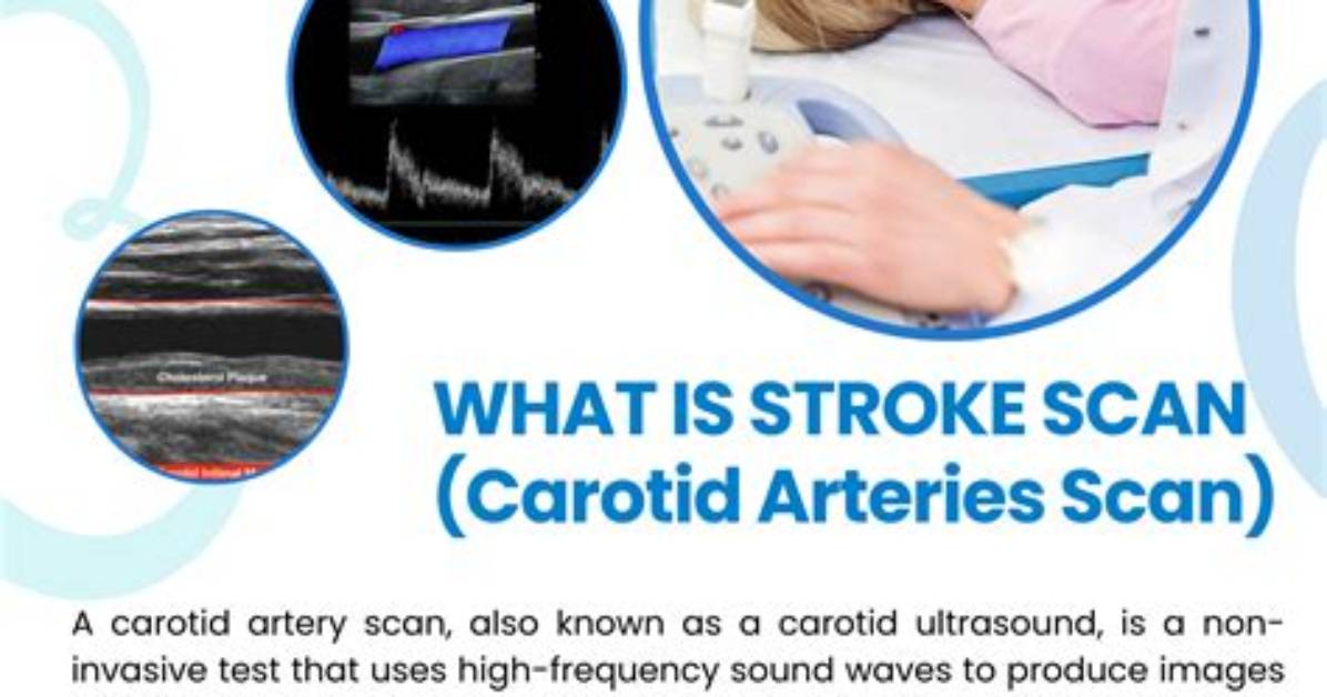 Why Would You Need a Carotid Ultrasound