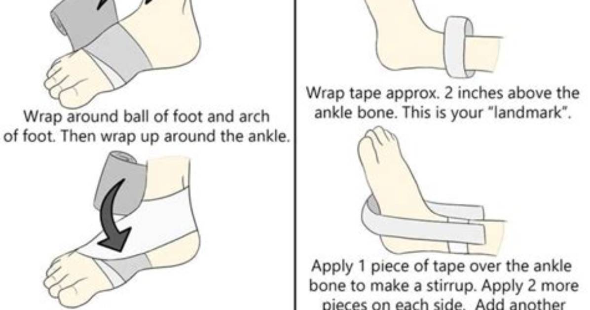 Why Wrap Sprained Ankle?