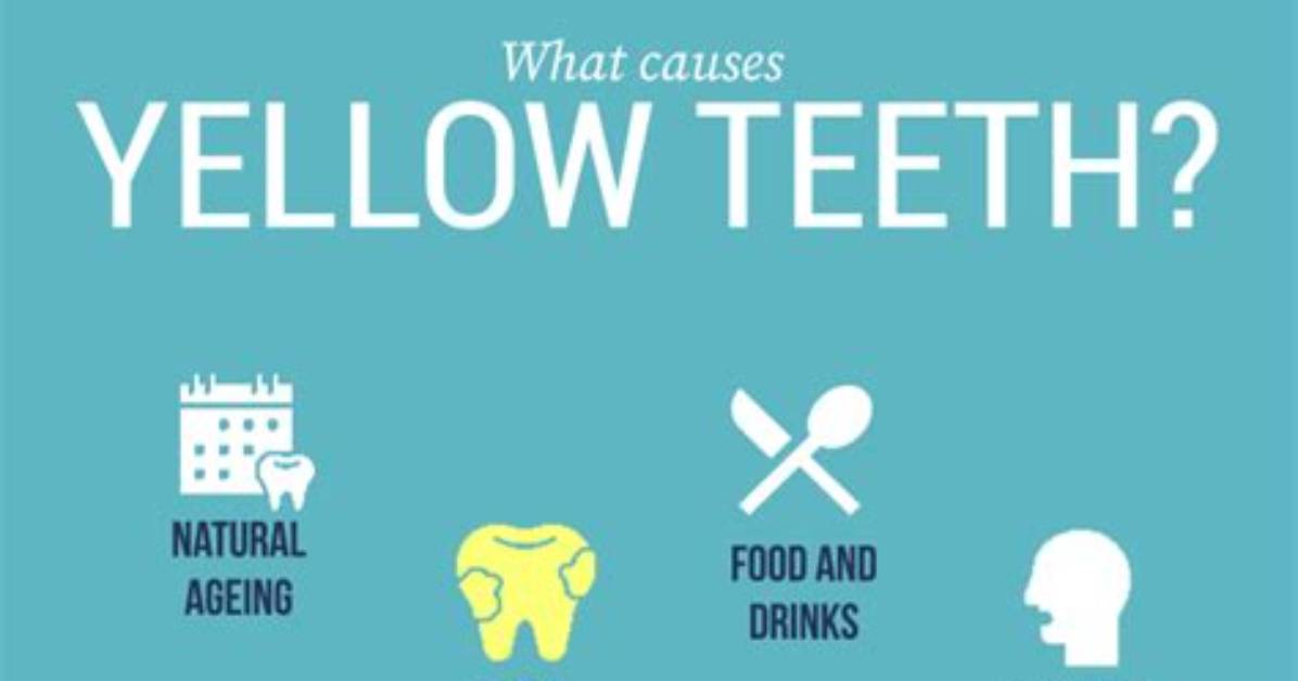Why Your Teeth Gets Yellow?