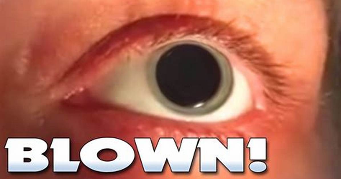 Will a Blown Pupil Heal?