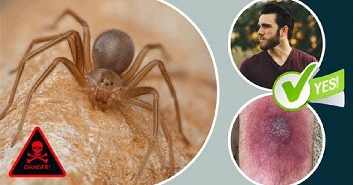 Will a Brown Recluse Kill You?