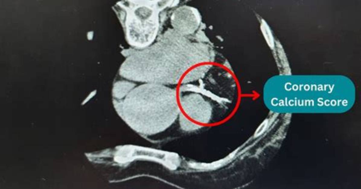Will a Ct Scan Show Calcification?