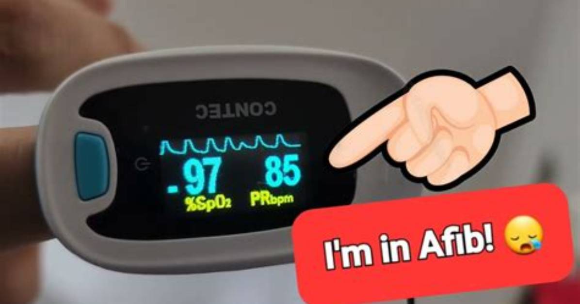 Will a Pulse Oximeter Detect Afib?