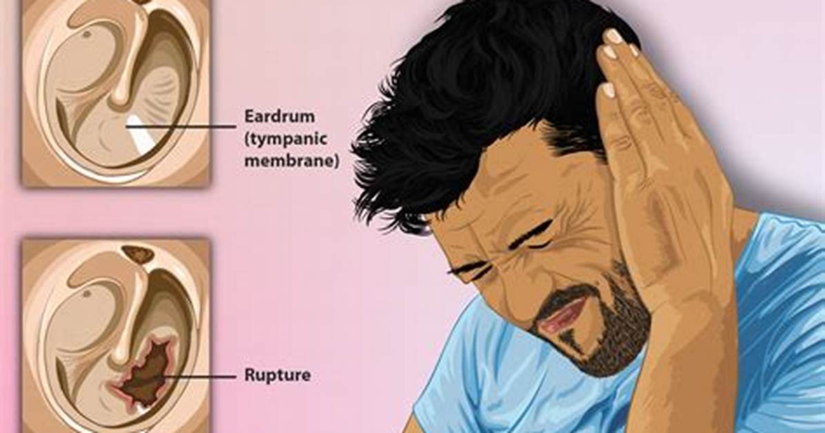 Will a Punctured Eardrum Heal Itself?