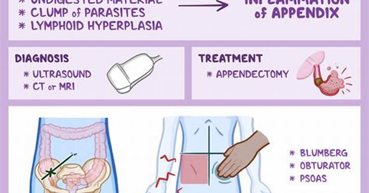 Will Appendicitis Kill You?