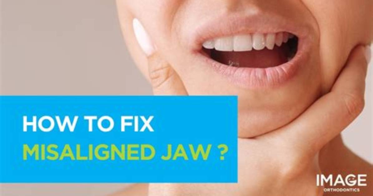 Will Braces Fix My Misaligned Jaw?