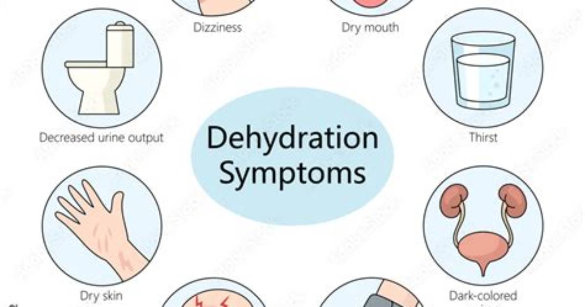 Will Dehydration Cause Dizziness?