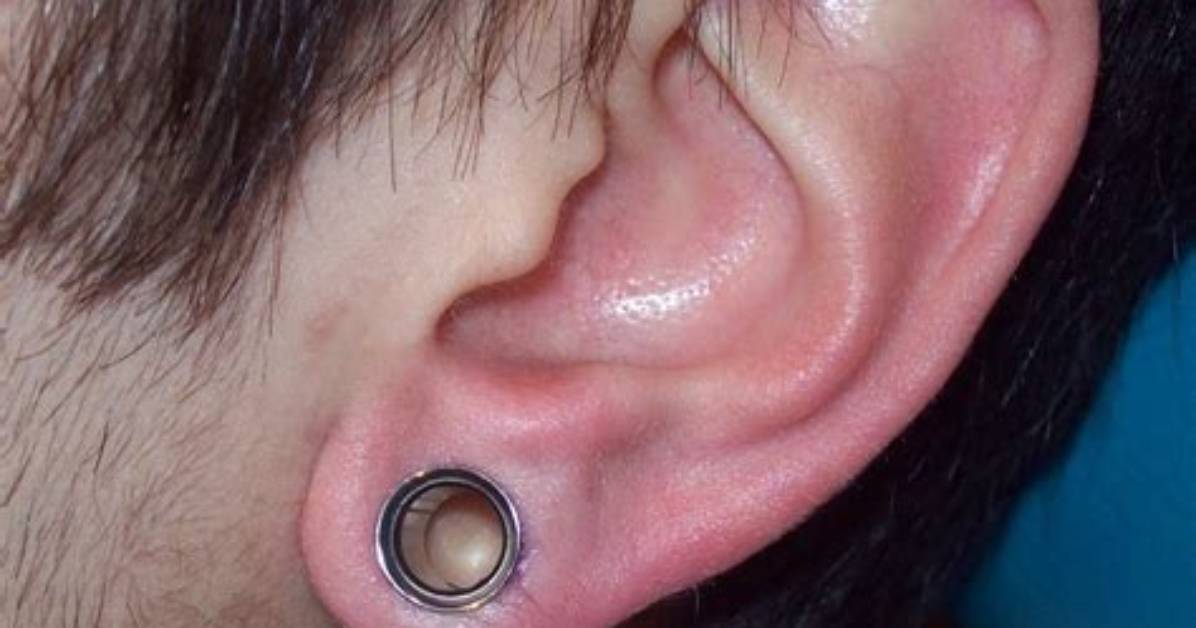 Will Double Zero Gauges Close up?
