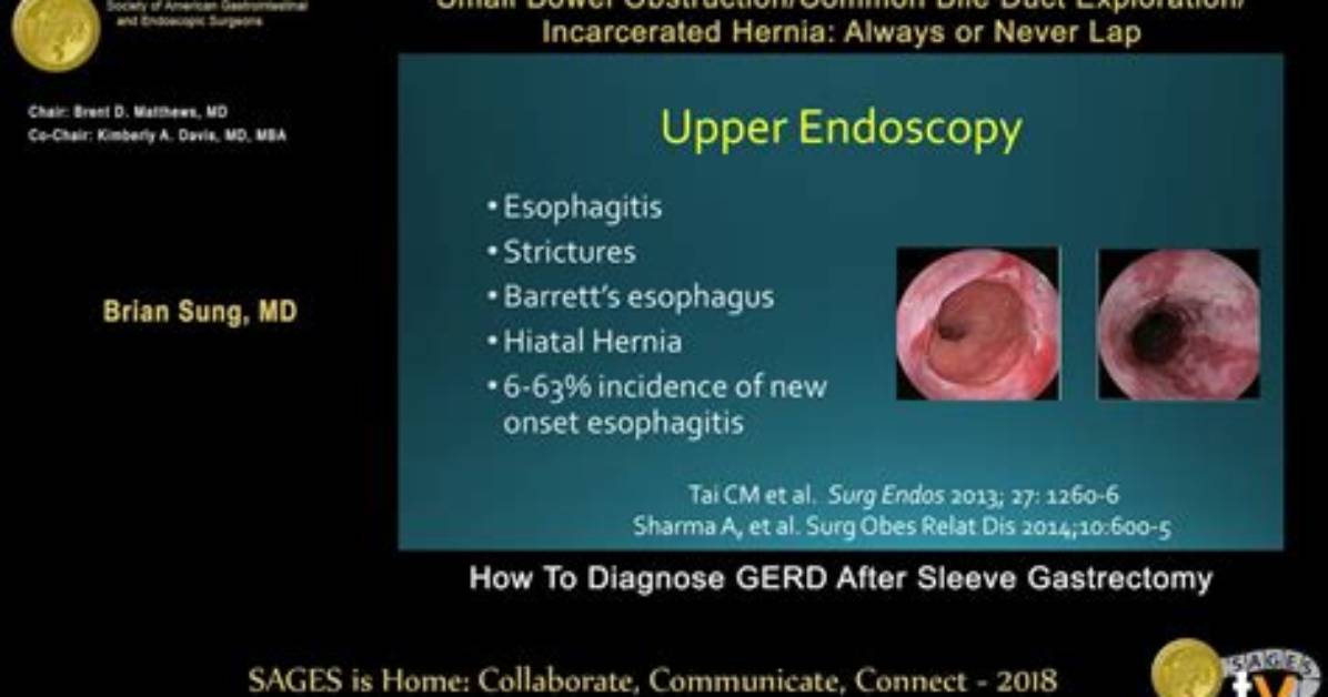 Will Endoscopy Show Gerd?