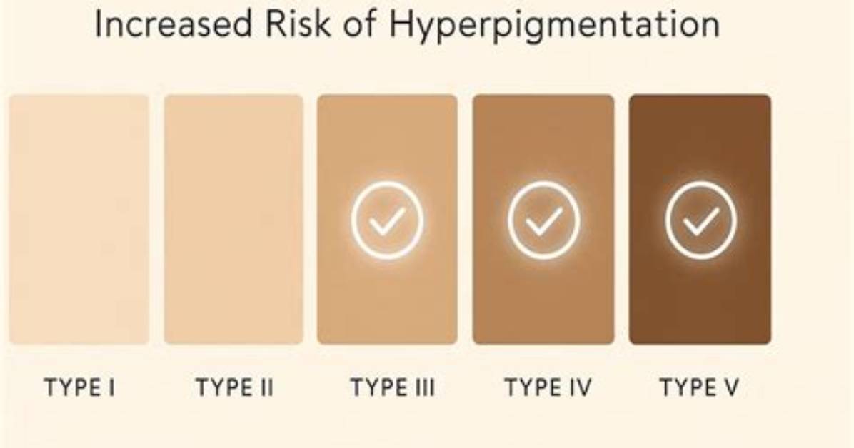 Will Hyperpigmentation from Waxing Go Away?