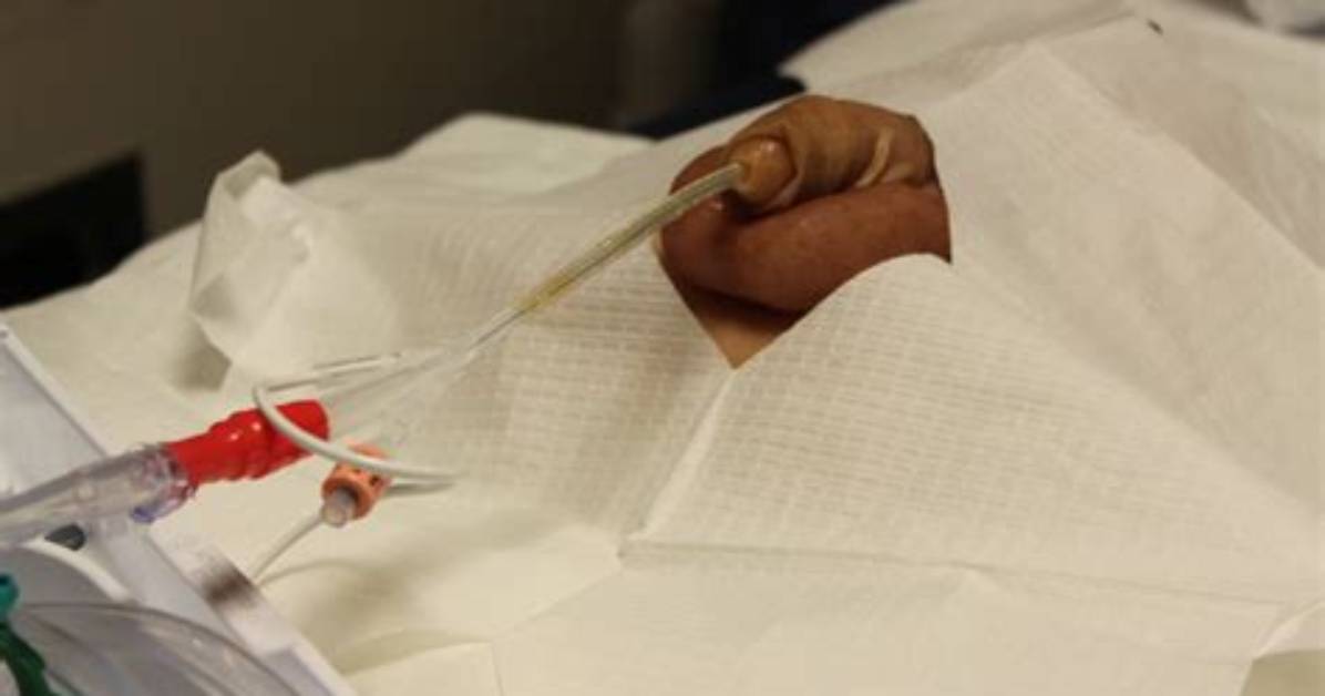Will I Be Catheterized During Surgery?