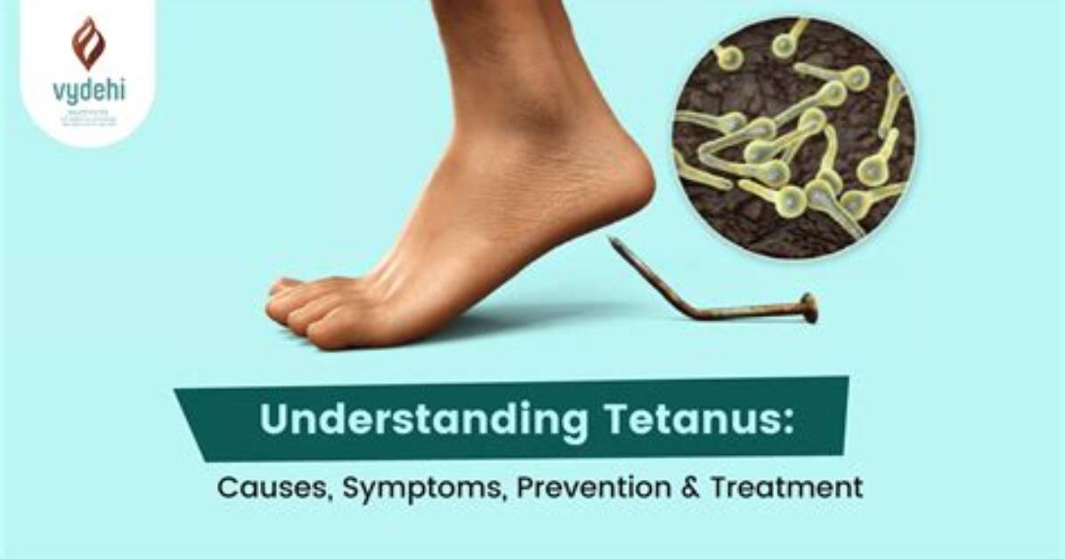 Will I Get Tetanus from Stepping on a Rusty Nail?