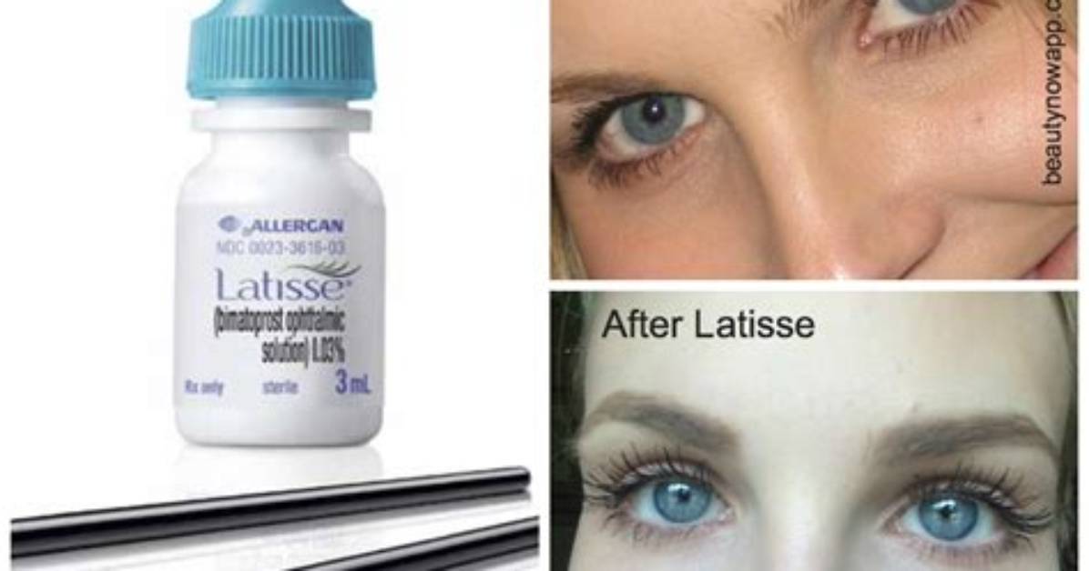 Will Latisse Work on Eyebrows?