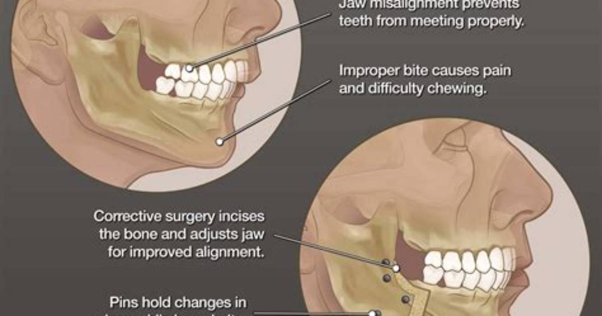 Will My Jaw Realign Itself?