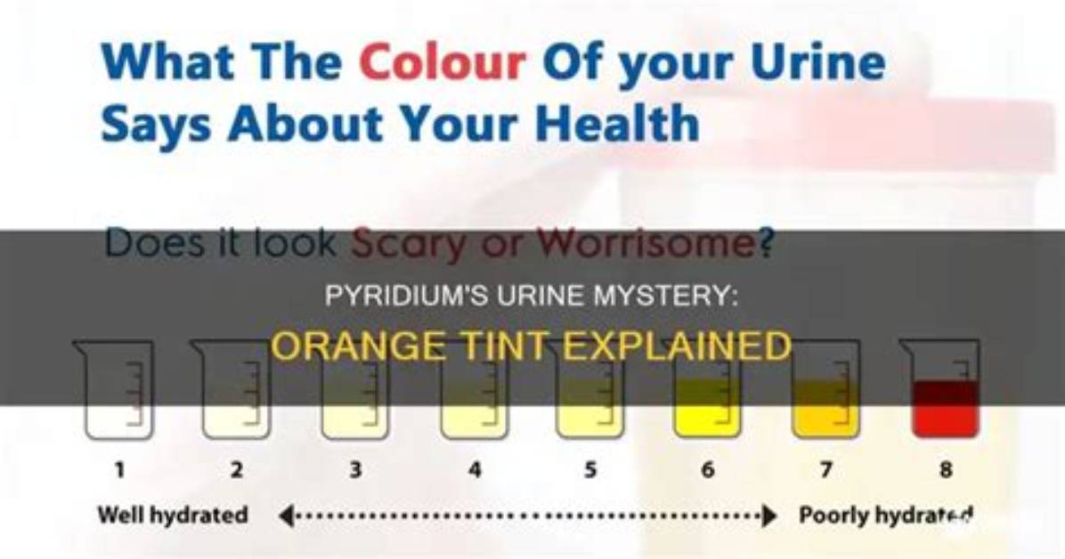 Will Pyridium Affect a Urine Test?