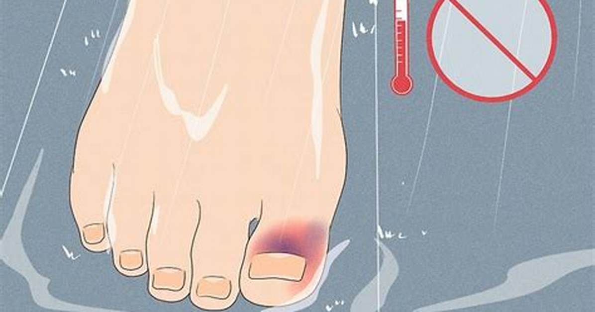 Will Soaking a Bruised Toe Help?