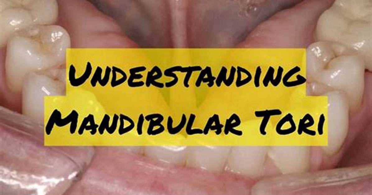 Will Torus Mandibularis Go Away?