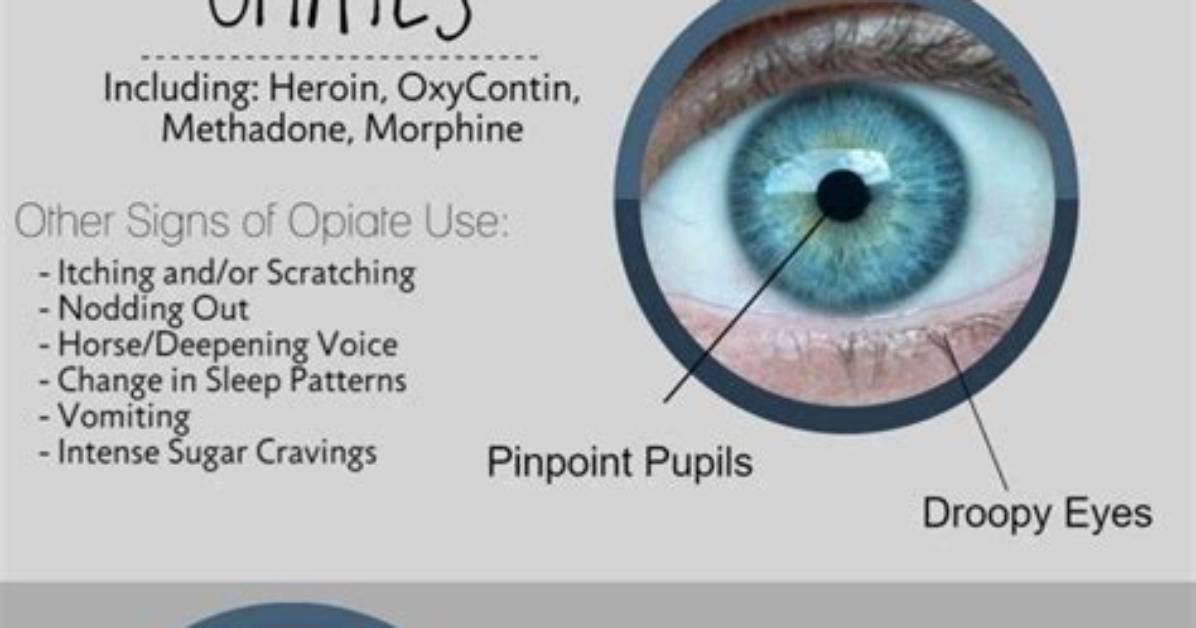 Will Xanax Constrict Pupils?