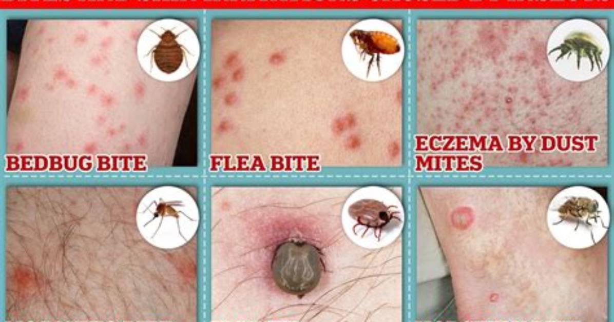 Would a Bed Bug Only Bite Once?