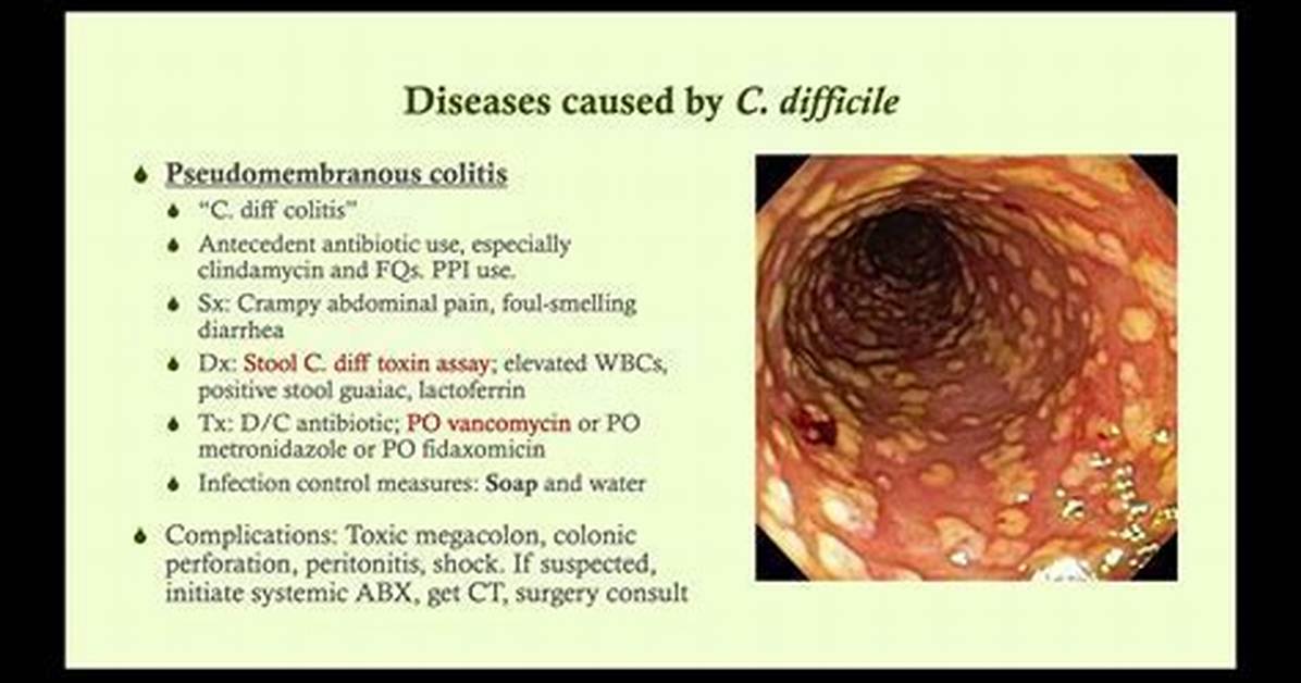 Would a Colonoscopy Show C Diff?