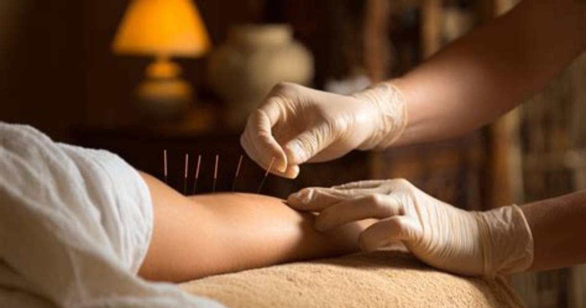 Would Acupuncture Help Scleroderma?