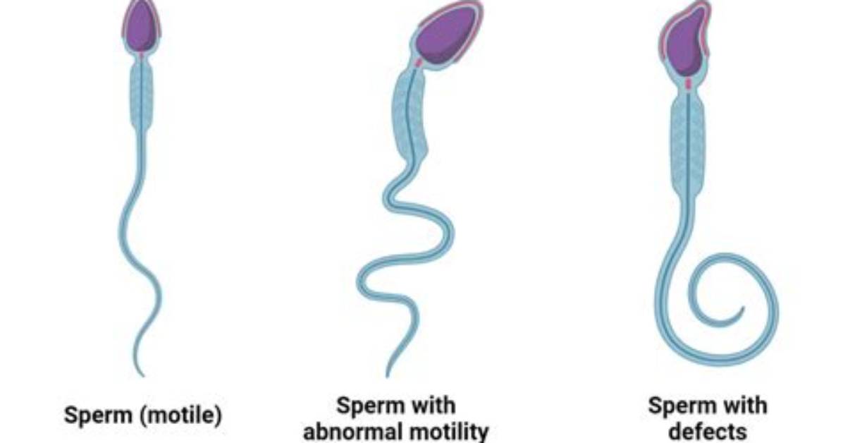 Would Each Sperm Make a Different Person?