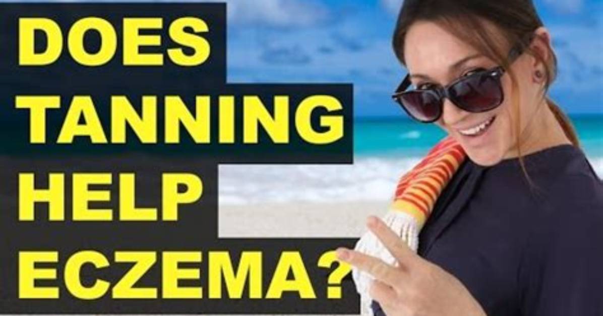 Would Tanning Help Eczema?