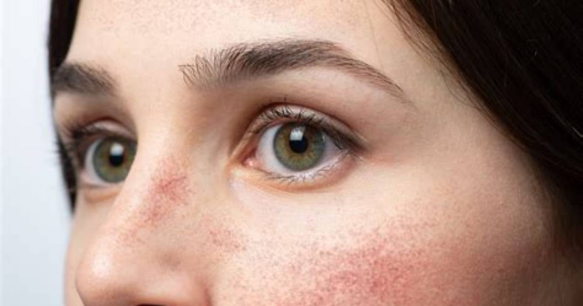 Would Your Cheeks Turn Red?